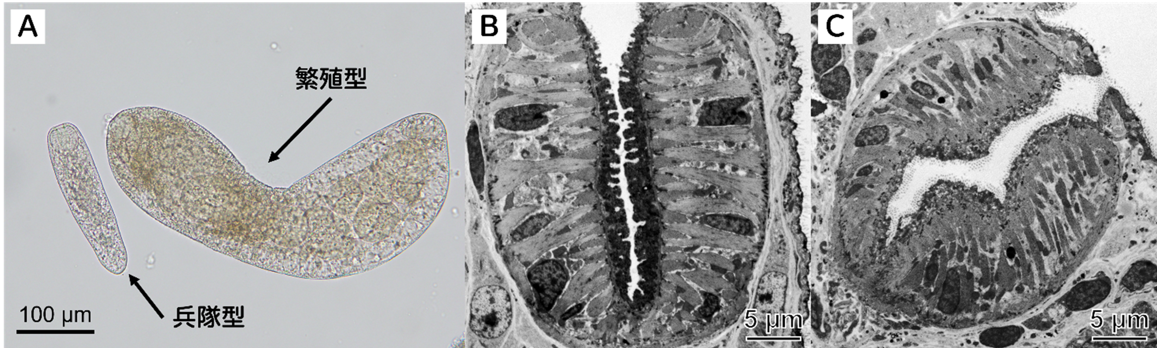 寄生虫の「兵隊」の口は吸い付きに特化していた～二生吸虫の兵隊型レジアの武器形質の構造を世界で初めて解明～