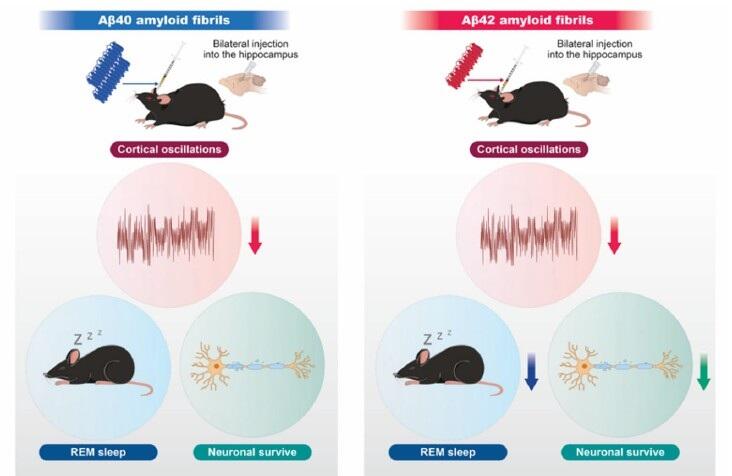 アミロイドの種類が睡眠と脳活動を左右する ～線維化Aβ40と線維化Aβ42がマウスの睡眠・皮質脳波に異なる影響～