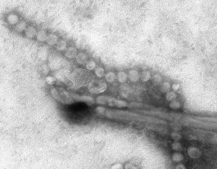 H7N9亜型インフルエンザの電子顕微鏡写真