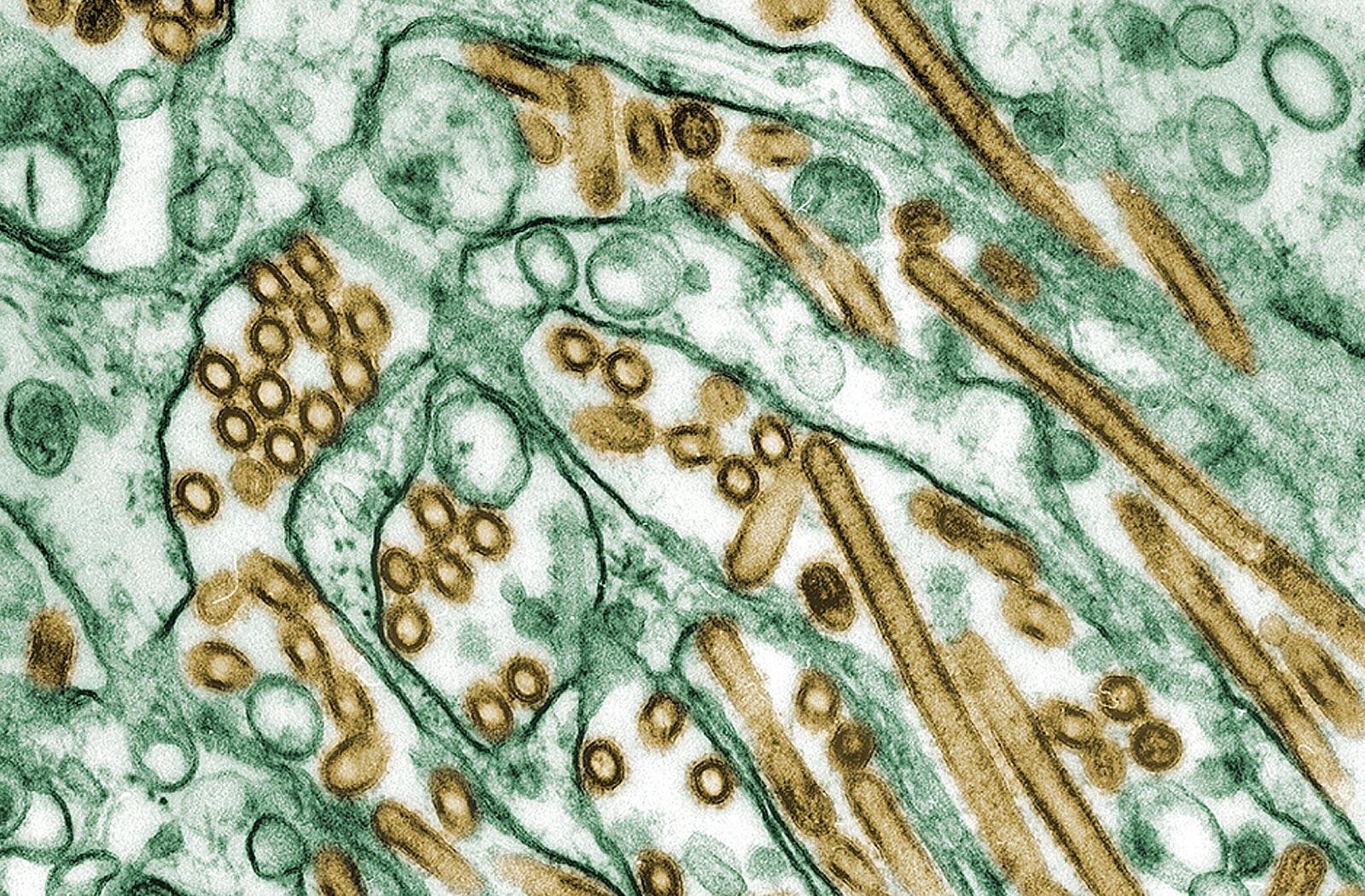 透過型電子顕微鏡で撮影したH5N1亜型鳥インフルエンザウイルスの写真。