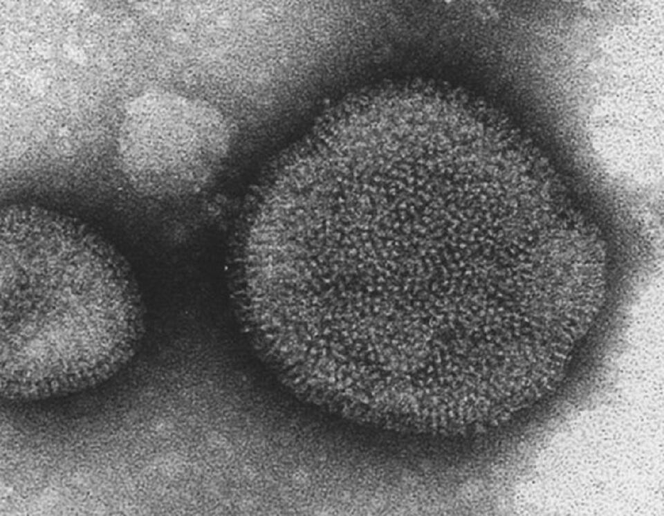 A/duck/Hokkaido/5/77 (H3N2) ウイルスの電子顕微鏡写真