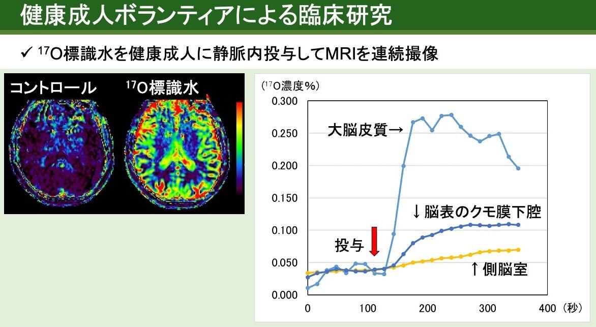 100秒を過ぎたあたりから、脳の中央の脈絡叢よりも外側の大脳皮質に標識水が多く漏出することがわかる鮮明画像とグラフ