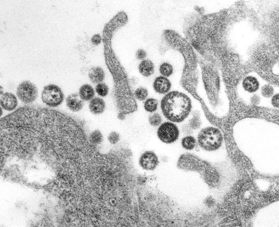 透過型電子顕微鏡で撮影したラッサウイルス。ウイルス粒子の周辺にあるのは細胞の破片